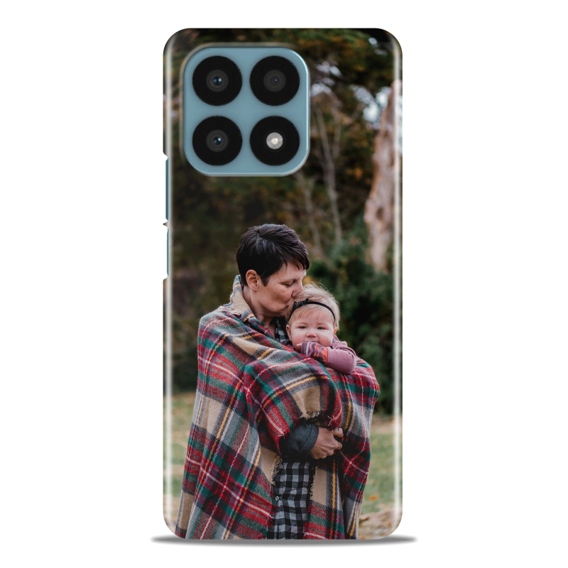 Coque personnalisée Honor X8a