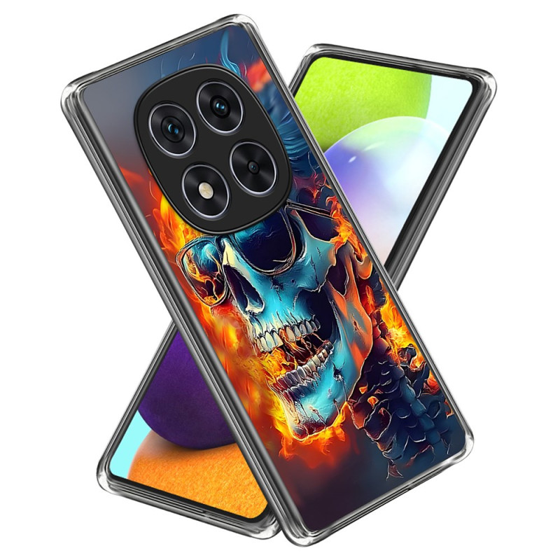 Xiaomi Redmi Note 14 Pro 4G Suojakuori
 Liekehtivä pääkallo